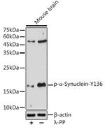 Phospho-alpha Synuclein (Tyr136) Antibody in Western Blot (WB)