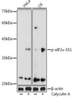 Phospho-EIF2S1 (Ser51) Antibody in Western Blot (WB)