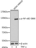 Phospho-NFkB p100 (Ser866) Antibody in Western Blot (WB)