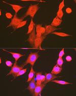 Phospho-PDPK1 (Ser241) Antibody in Immunocytochemistry (ICC/IF)