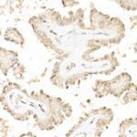 Phospho-YAP1 (Ser127) Antibody in Immunohistochemistry (Paraffin) (IHC (P))