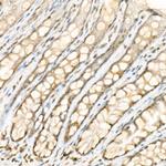 Phospho-YAP1 (Ser127) Antibody in Immunohistochemistry (Paraffin) (IHC (P))