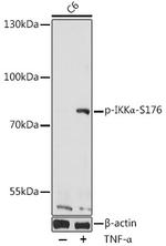 Phospho-IKK alpha (Ser176) Antibody in Western Blot (WB)