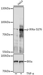 Phospho-IKK alpha (Ser176) Antibody in Western Blot (WB)