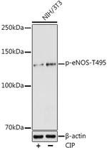 Phospho-eNOS (Thr495) Antibody in Western Blot (WB)