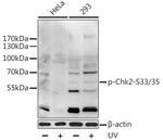 Phospho-CHK2 (Ser33, Ser35) Antibody in Western Blot (WB)