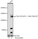 Phospho-TrkA/TrkB (Tyr674, Tyr675, Tyr706, Tyr707) Antibody in Western Blot (WB)