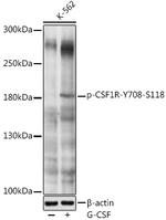 Phospho-CSF1R (Tyr708) Antibody in Western Blot (WB)