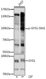 Phospho-GYS1 (Ser641) Antibody in Western Blot (WB)