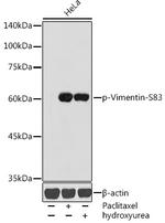 Phospho-Vimentin (Ser83) Antibody in Western Blot (WB)