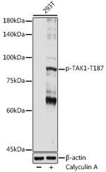 Phospho-TAK1 (Thr187) Antibody in Western Blot (WB)