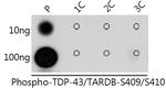 Phospho-TDP-43 (Ser409, Ser410) Antibody in Dot Blot (DB)