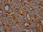 Clathrin Heavy Chain Antibody in Immunohistochemistry (Paraffin) (IHC (P))