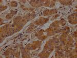 Clathrin Heavy Chain Antibody in Immunohistochemistry (Paraffin) (IHC (P))