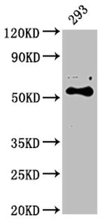 CYP27B1 Antibody in Western Blot (WB)