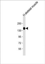 AGL Antibody in Western Blot (WB)