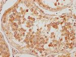 KBTBD7 Antibody in Immunohistochemistry (Paraffin) (IHC (P))