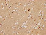 KBTBD7 Antibody in Immunohistochemistry (Paraffin) (IHC (P))