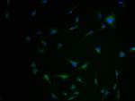 Kir2.2 (KCNJ12) Antibody in Immunocytochemistry (ICC/IF)