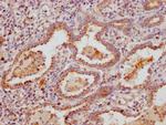 MUC5B Antibody in Immunohistochemistry (Paraffin) (IHC (P))