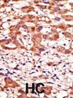 MGAT1 Antibody in Immunohistochemistry (Paraffin) (IHC (P))