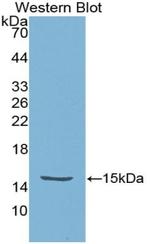 HTRA1 Antibody in Western Blot (WB)