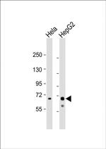 Ribophorin I Antibody in Western Blot (WB)