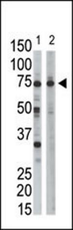 Ribophorin I Antibody in Western Blot (WB)