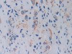 TOP3A Antibody in Immunohistochemistry (Paraffin) (IHC (P))