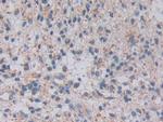 TOP3A Antibody in Immunohistochemistry (Paraffin) (IHC (P))