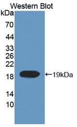 TOP3A Antibody in Western Blot (WB)