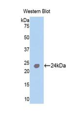 Troponin I Antibody in Western Blot (WB)