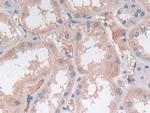 SRY Antibody in Immunohistochemistry (Paraffin) (IHC (P))