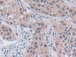 SRY Antibody in Immunohistochemistry (Paraffin) (IHC (P))