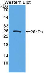 Sostdc1 Antibody in Western Blot (WB)