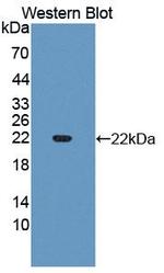 SLIT3 Antibody in Western Blot (WB)