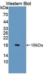 SLC22A4 Antibody in Western Blot (WB)