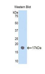 PLXNB1 Antibody in Western Blot (WB)