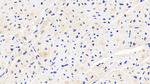 PLOD1 Antibody in Immunohistochemistry (Paraffin) (IHC (P))