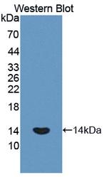 PLOD1 Antibody in Western Blot (WB)