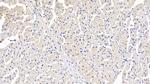 ITGA11 Antibody in Immunohistochemistry (Paraffin) (IHC (P))