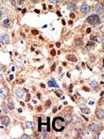 PML Antibody in Immunohistochemistry (Paraffin) (IHC (P))