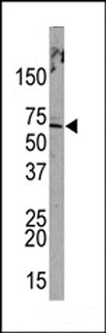 PML Antibody in Western Blot (WB)