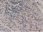 HPR Antibody in Immunohistochemistry (Paraffin) (IHC (P))