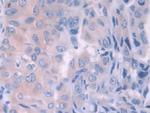 HFE2 Antibody in Immunohistochemistry (Paraffin) (IHC (P))