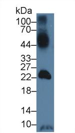 GLUT14 Antibody in Western Blot (WB)