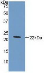 c-Mpl Antibody in Western Blot (WB)