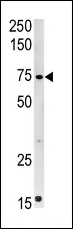 CPT2 Antibody in Western Blot (WB)