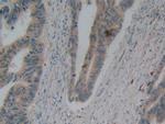 beta-2 Defensin Antibody in Immunohistochemistry (Paraffin) (IHC (P))