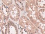 ATP7B Antibody in Immunohistochemistry (Paraffin) (IHC (P))